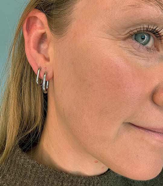 Noelia Øreringe – 18 & 20 mm Hoops