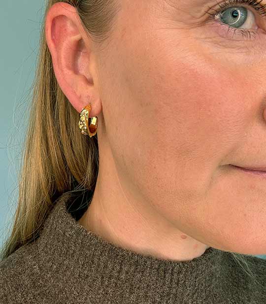 AURIEL – Krystaløreringe