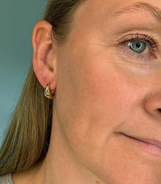 Alva Øreringe – guldbelagt med pink sten