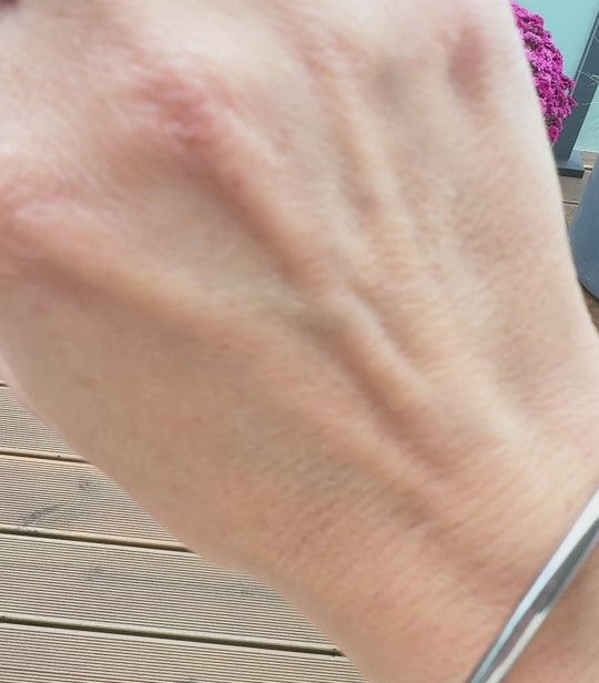 CLEA - RING